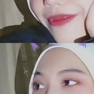 A B E L profile