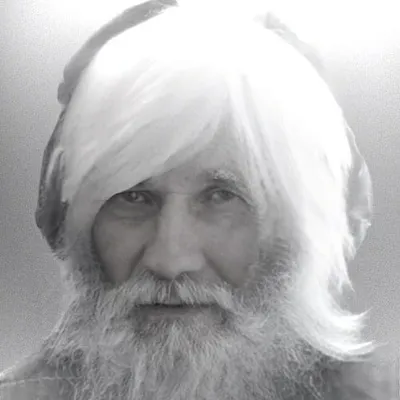 Albino profile