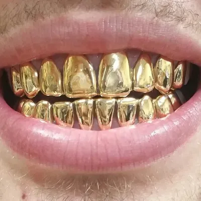 Benzino Jewelry Grillz profile
