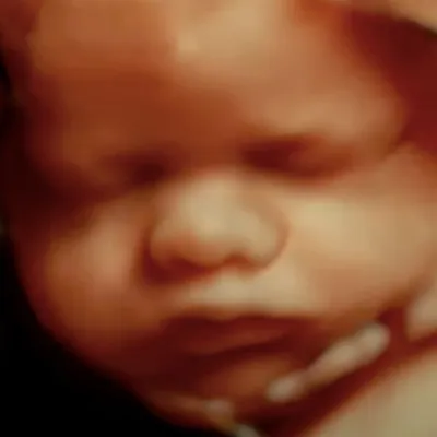 Baby's First Ultrasound profile
