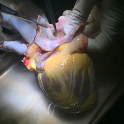 Cardiovasc & Endovasc Surgery profile