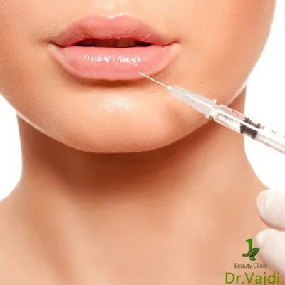 ژل بوتاكس ليپوماتيك کامپوزیت profile