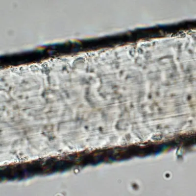 C L Trickett profile