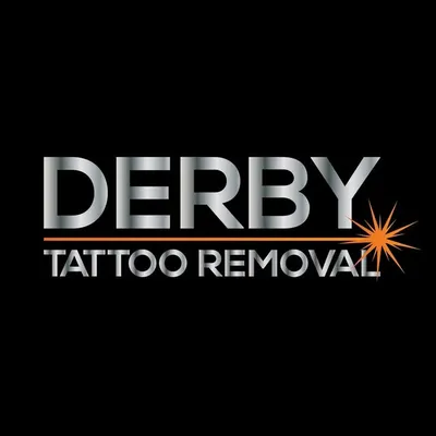 Derby Tattoo Removal profile