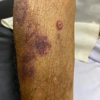 Dermatology Blogger profile