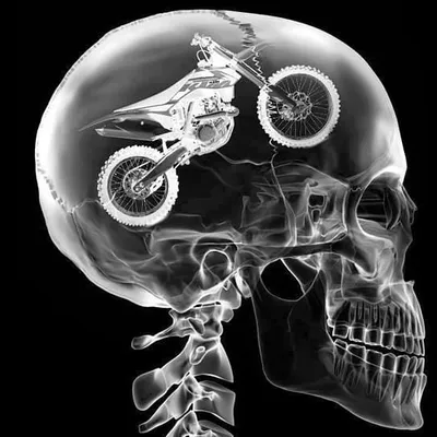 Motocross | Enduro | Supermoto profile