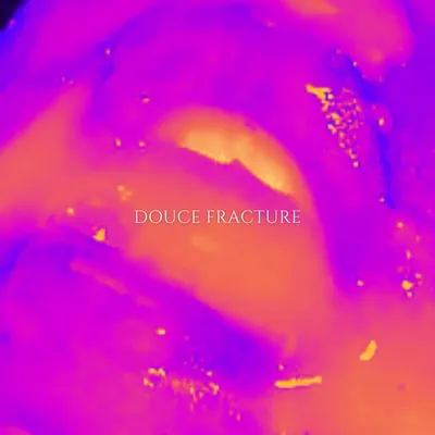 Douce Fracture profile