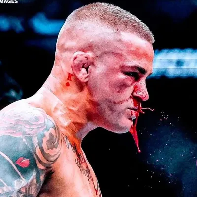 Dustin Poirier profile
