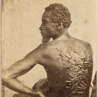Emancipation profile