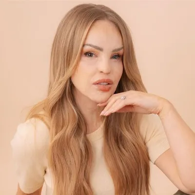 Katie Piper OBE profile
