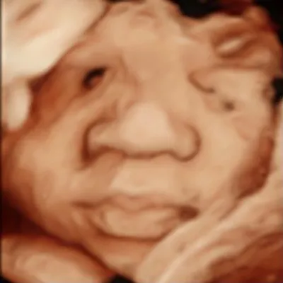 Love at First Sight profile