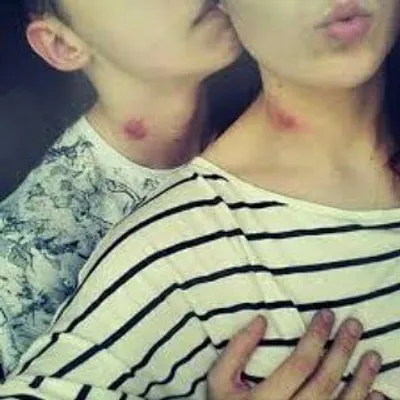 Love Bite profile