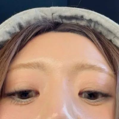YOPI profile