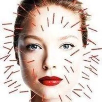 Sensei Acupuncture Beauty profile
