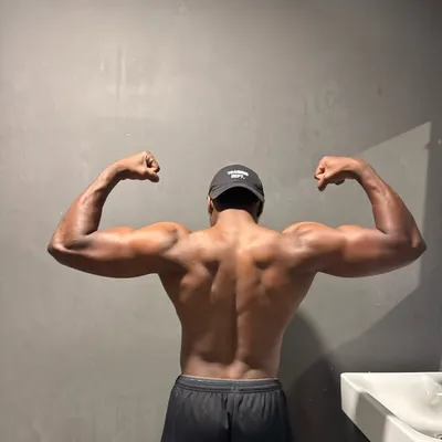 SCAR profile
