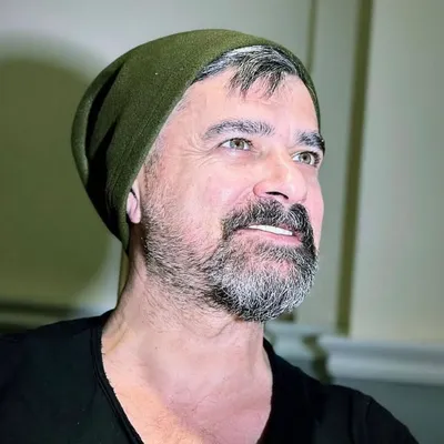 Serkan Aydın Hairtransplant profile