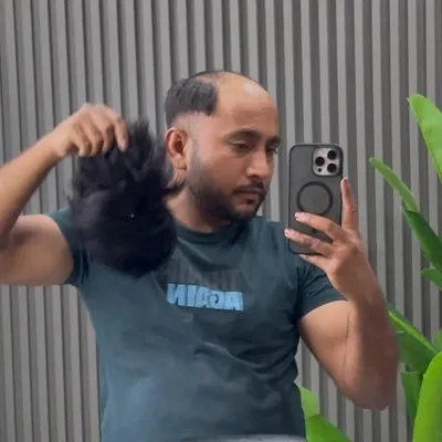Wigcenter00 hair patch Jalandhar profile