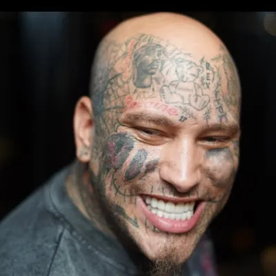 Stitches profile