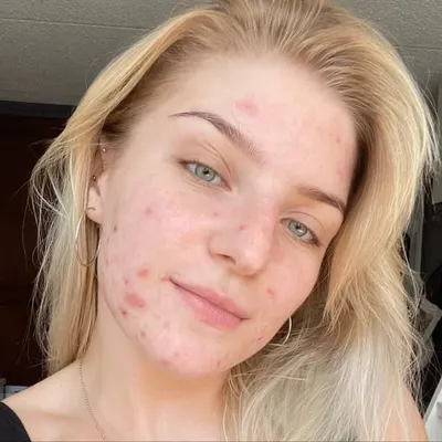 Vee’s Skin Story📖 profile