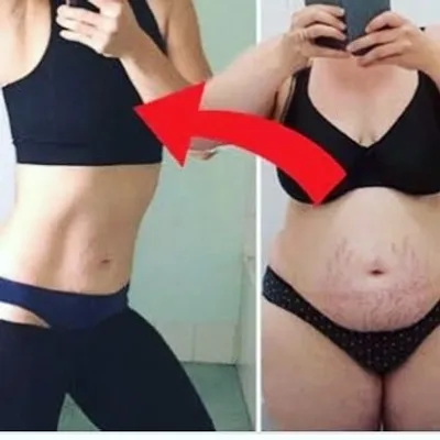 WEIGHT LOSS JOURNEY profile