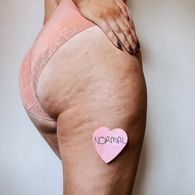 Body Confidence & Self-Love🌟 profile