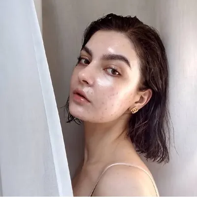 Yuki • Skin Positivity & BDD profile